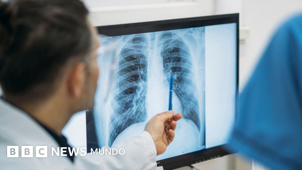 Papa León XIV es diagnosticado con adenocarcinoma pulmonar tras cirugía exitosa en Roma