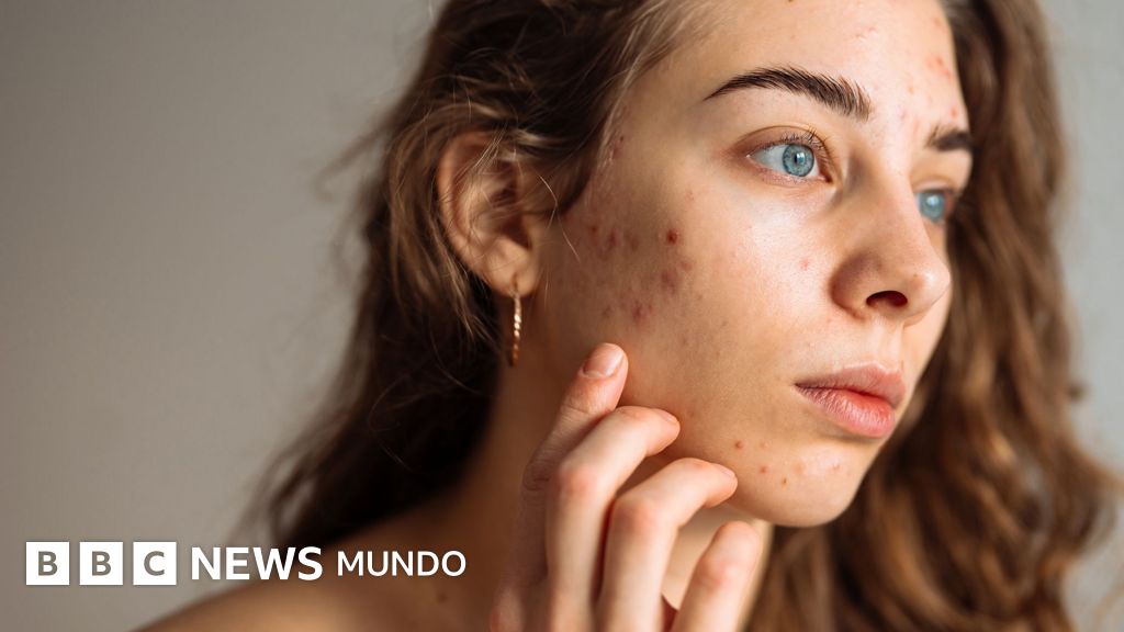 Expertos advierten sobre los riesgos de las rutinas complejas de cuidado de la piel en adolescentes