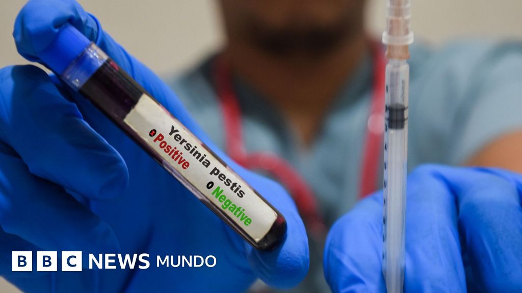 Investigan muerte de trabajadora en laboratorio de peste en Siberia: ¿Qué es la peste neumónica?