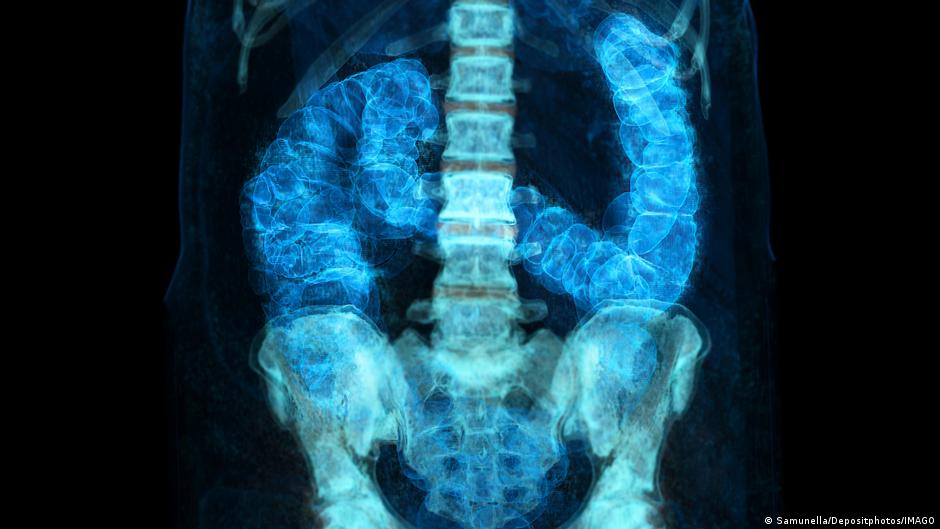 Alerta global: aumentan casos de cáncer en menores de 50 años